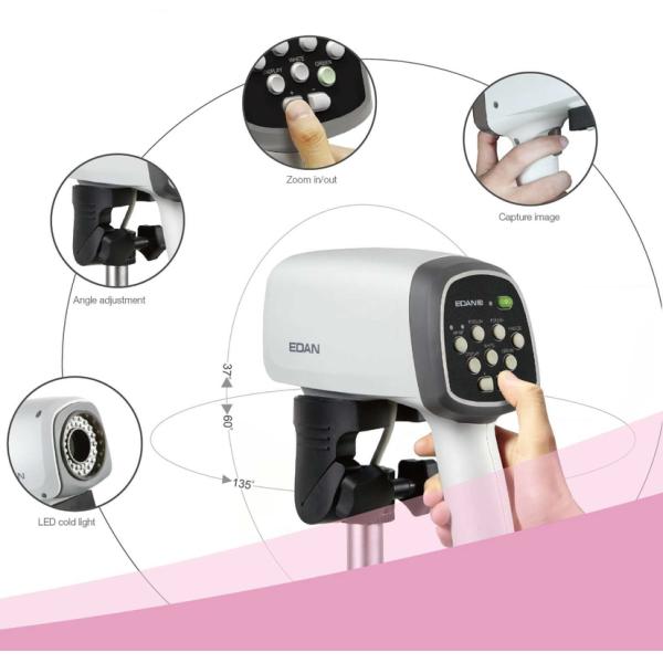 EDAN C3A&C6A Video Colposcope