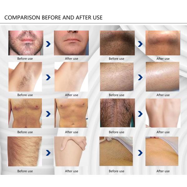 Customized 800W Diode Hair Removal Laser Machine 60 Million Light Outputs