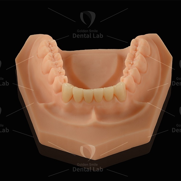 E Max Bridge Emax Laminate Veneers Lithium Disilicate Glass Ceramic Material