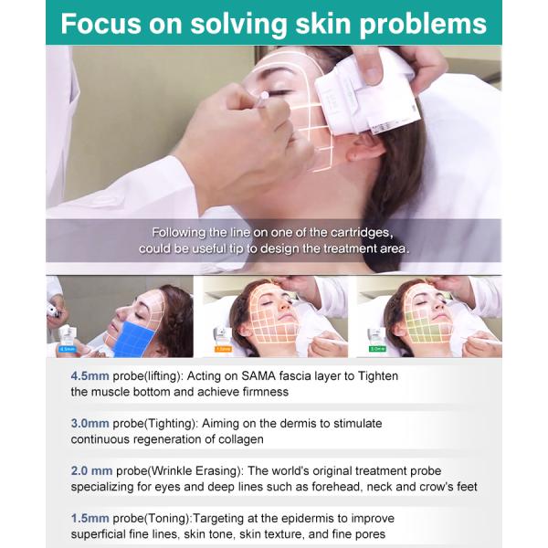 HIFU Skin Tightening Machine with Time Difference Protection