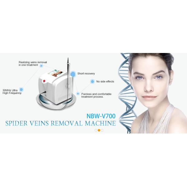 Spider vein laser removal Laser varicose vein removal treatment