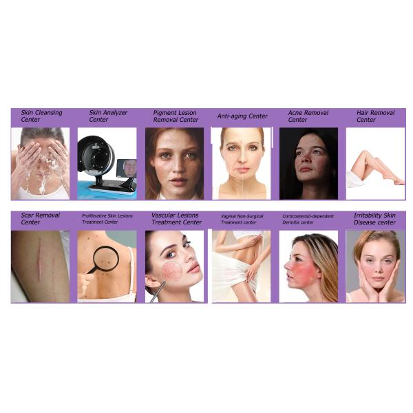 cavitation fat remove Massager beauty weight lose velaslim roller rf vela slim machine