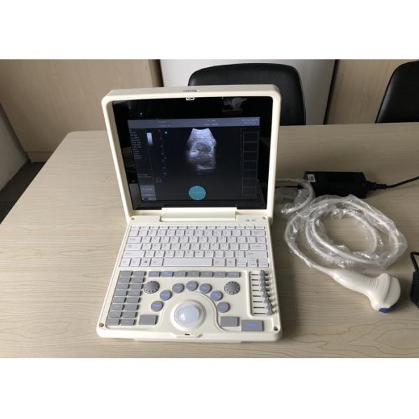 Digital Portable Mobile Laptop Ultrasound Scanner Medical Equipment BIO 3000J With 1.12 Inch LED Screen