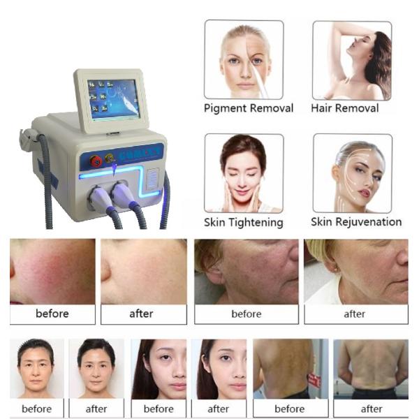 1-10ms IPL SHR Elight Machine For Hair Removal / Skin Rejuvenation