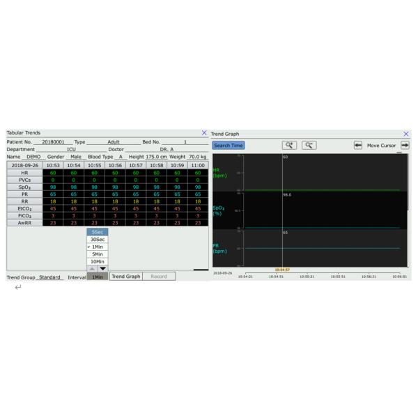 criticare patient monitor Aurora 8S 8.4-inch lightweight semi-modular criticare patient monitor for ambulance
