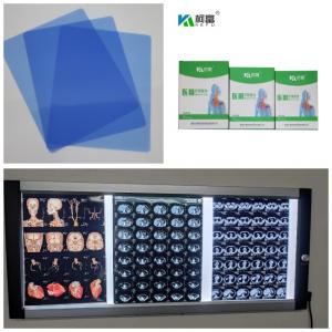 China Output 280gsm Medical X Ray Film Inkjet Blue Base For DR CT MRI Image 10x12 11x14 A4 A3 on sale