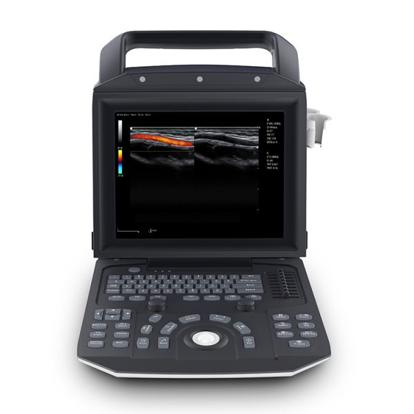 Portable Full Digital Color Doppler Ultrasound System Medical Scanner Ultrasound