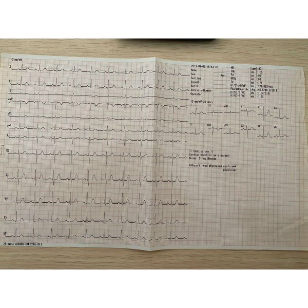 3 6 12 Channel ECG Machine Digital EKG Cardiograph for Hospital Cheap Price