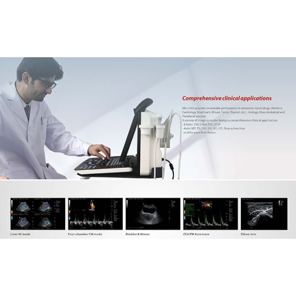 Portable Full Digital Color Doppler Ultrasound System Medical Scanner Ultrasound