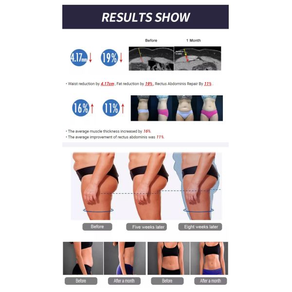 5 - 100Hz RF Body Slimming Machine 2800W Sculpture Weight Loss Machine Electrical