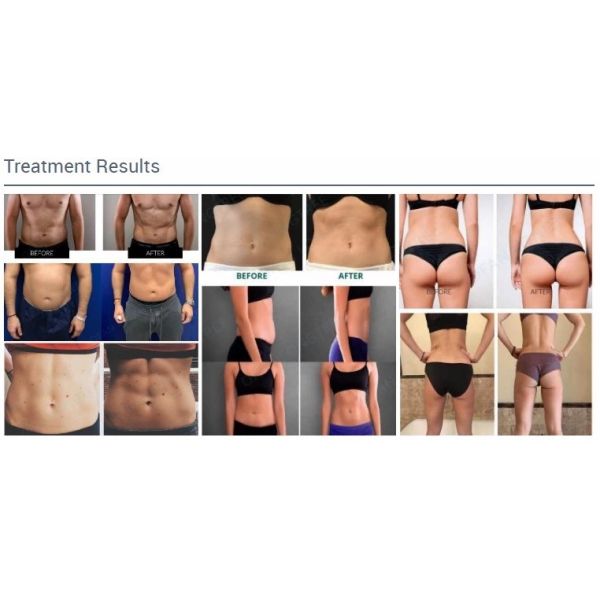 Toning Hips Tesla Sculptor Magnetic Body Sculpting Machine 4 Handles