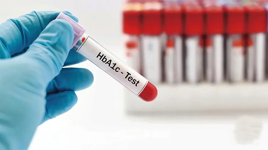 Closed System Magnetic Particle Chemiluminescent Immunoassay Kit Diabetes glycosylated hemoglobin (HbA1C)