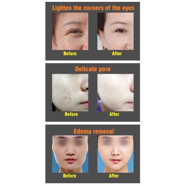 USB Rechargeable Face Lifting DC 5V 2.5W Hot Cold Face Massager
