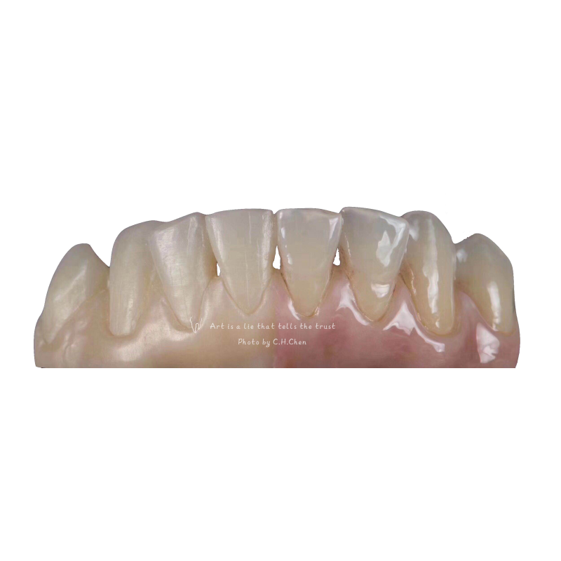 D98 Open System Zirconia Blocks Upcera 4D Explore