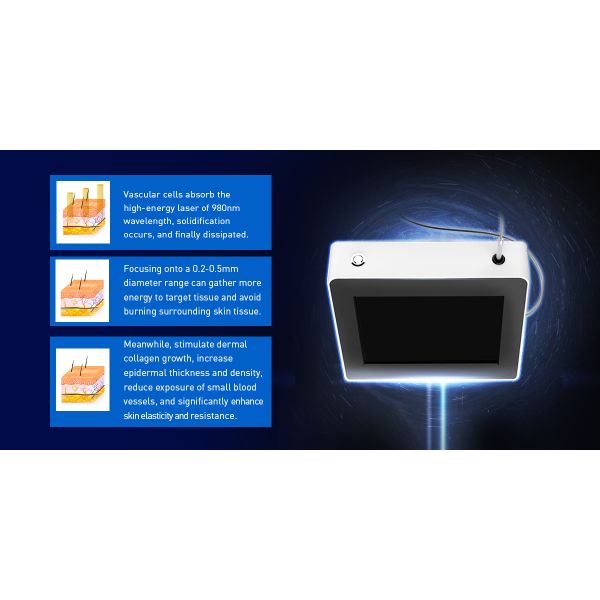 980 nm blood vascular cleaning vascular removal laser beauty device