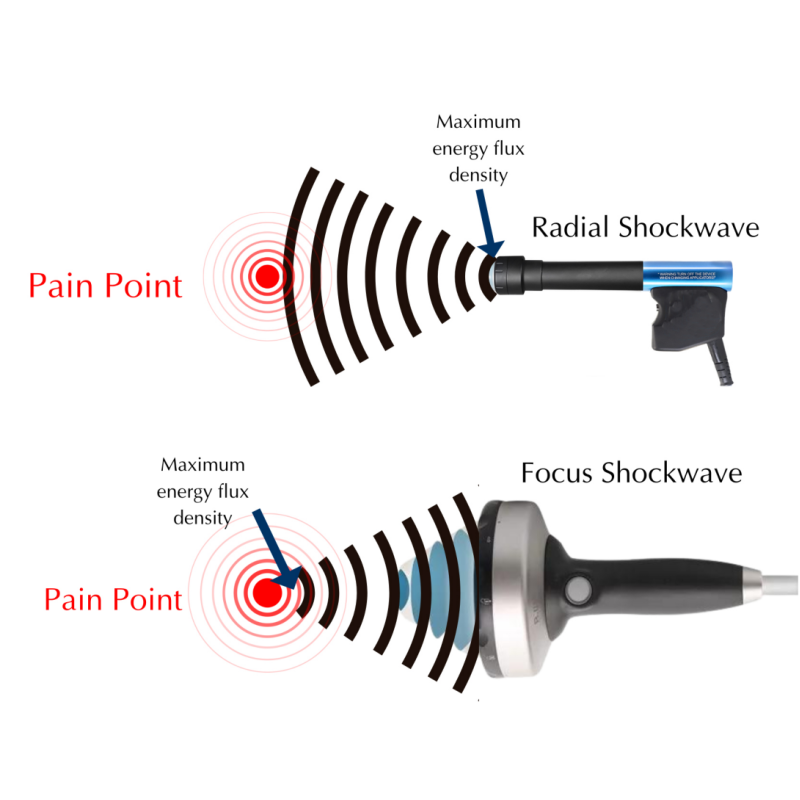 Ed Eswt Shockwave Therapy Focused Physiotherapy Machine Fat Cellulite Reduction