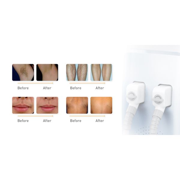 Double Handle 808nm Diode Laser Hair Removal Machine