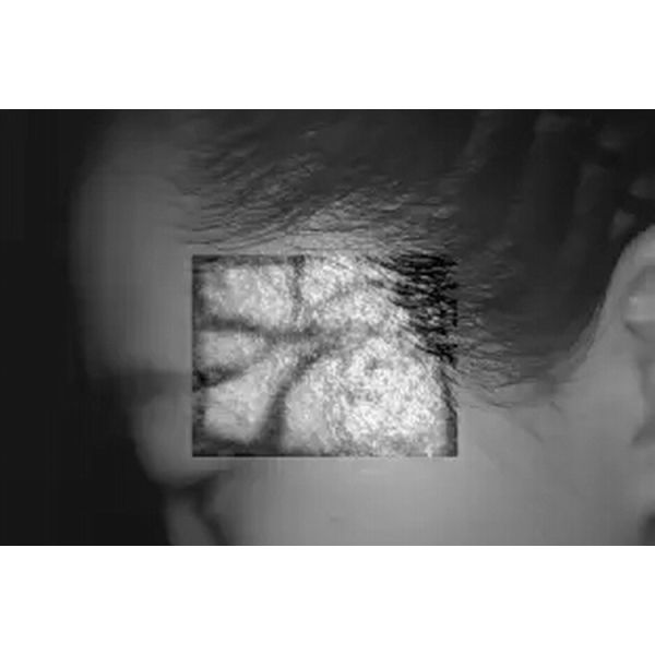 No Radiation Clear And Accurate Infrared Vein Finder With 2 Million Pixels Infrared Camera